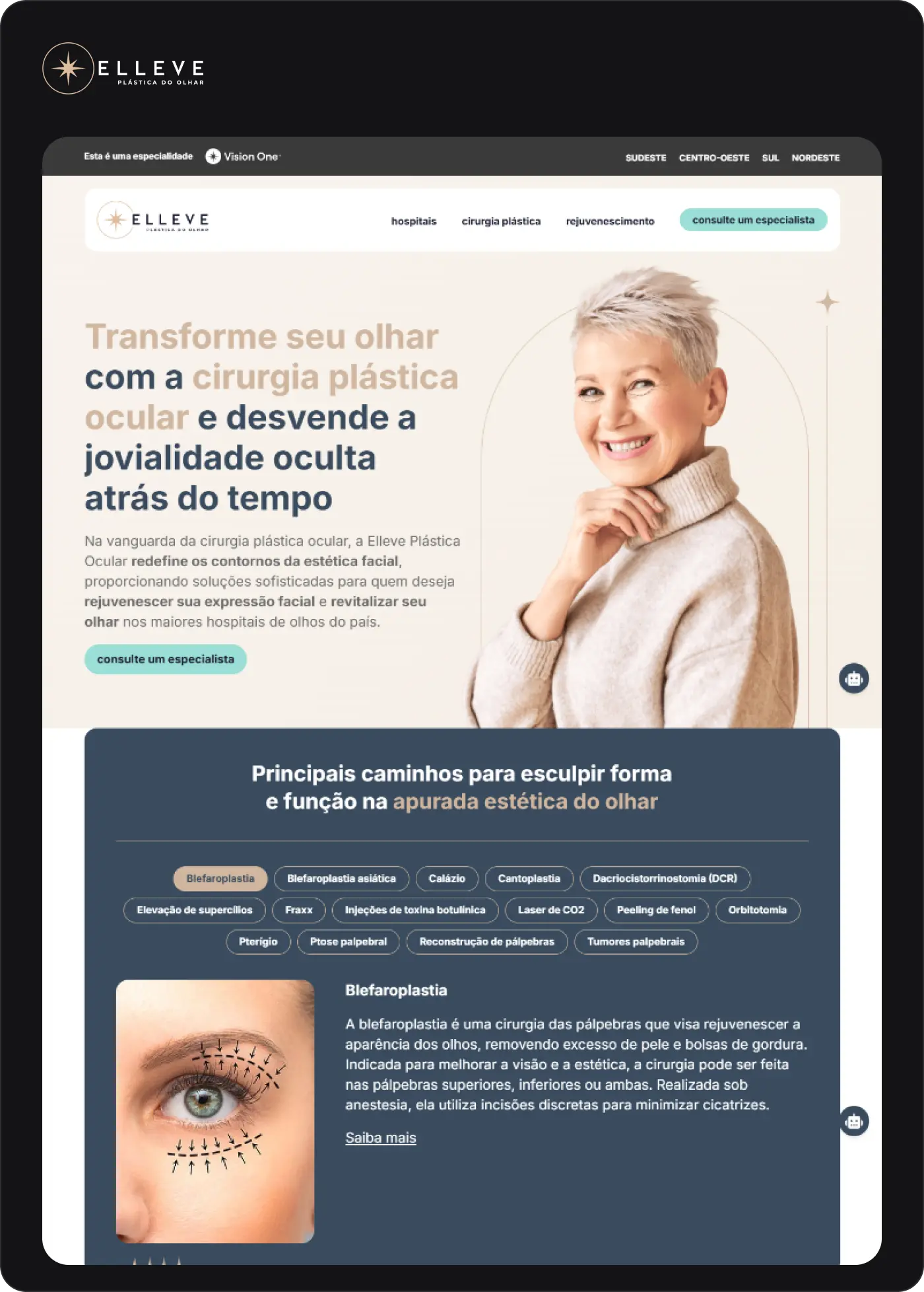 printscreen de site da Vision One, Elleve Plástica Ocular